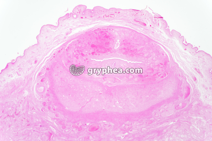 Pénis CT x1,5 - gryphea.com